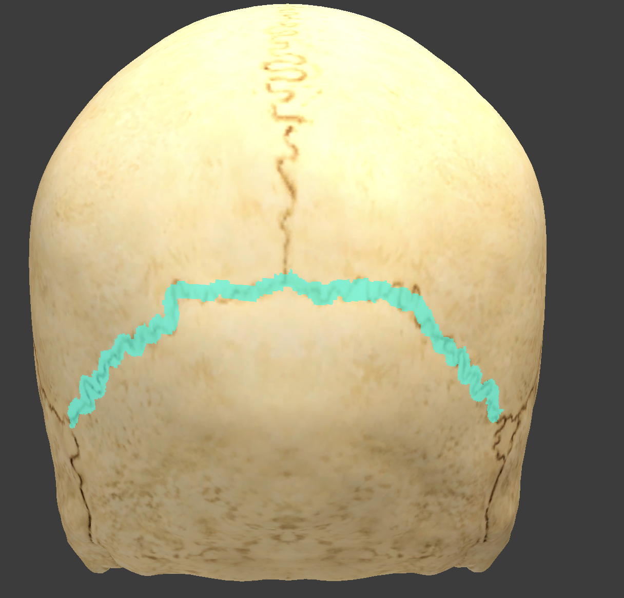 <p>what is this suture?</p>