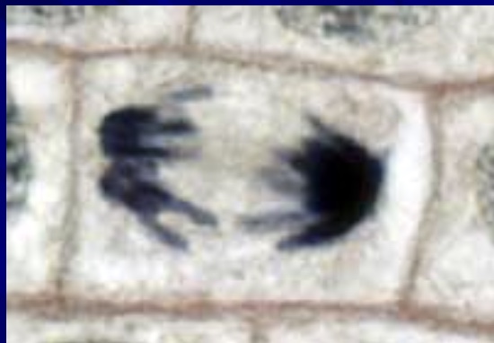 <p>what phase is this cell in&nbsp;</p>