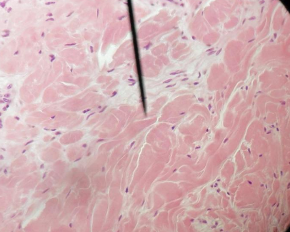 <p>Name this tissue</p>