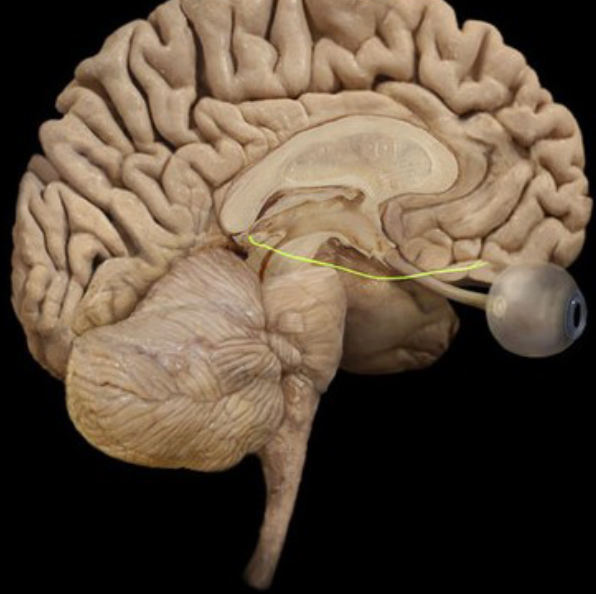 term image