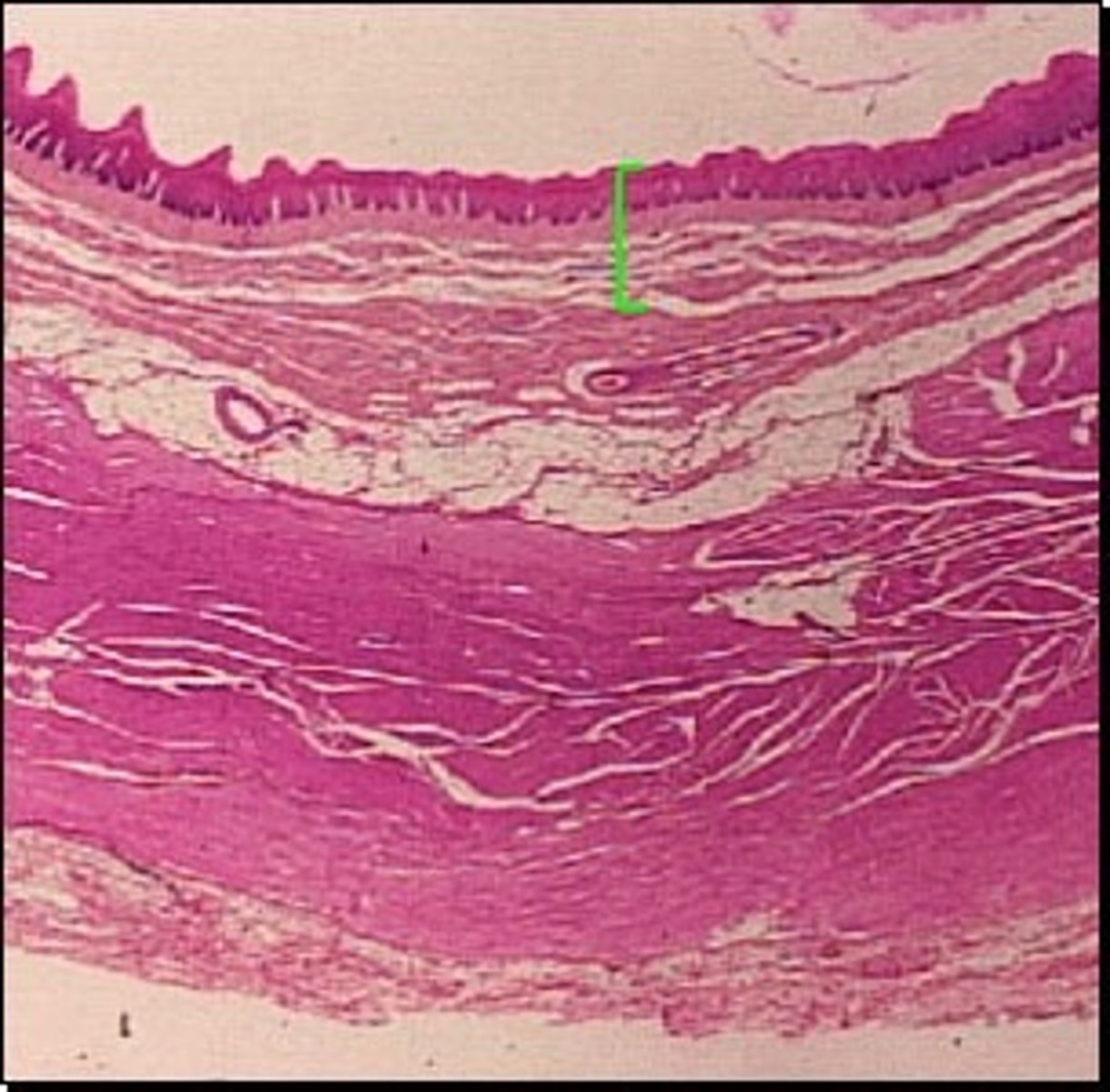 <p>(The mucous membrane) 1st layer from inside out.</p><p>Lines the lumen (open inside area) of the GI tract.</p><p>Simple columnar epithelium designed for absorption, secretion, protection.</p>