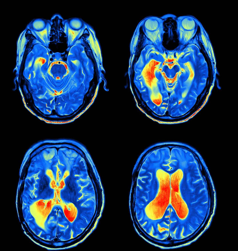 <p>applies <strong>powerful magnetic field</strong> to image the brain</p>