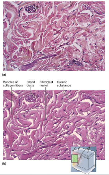 <p>Densely packed collagen fibers running in random directions; not a lot of open space (ground substance); few visible cells; scarcity of blood vessels</p>