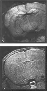 <p>blood vessels became more visible as blood oxygen decreased</p><p>basis for the blood-oxygen-level-dependent (BOLD) effect used for functional MRI</p><p>BOLD dominate fMRI studies that map human brain function</p><p></p>