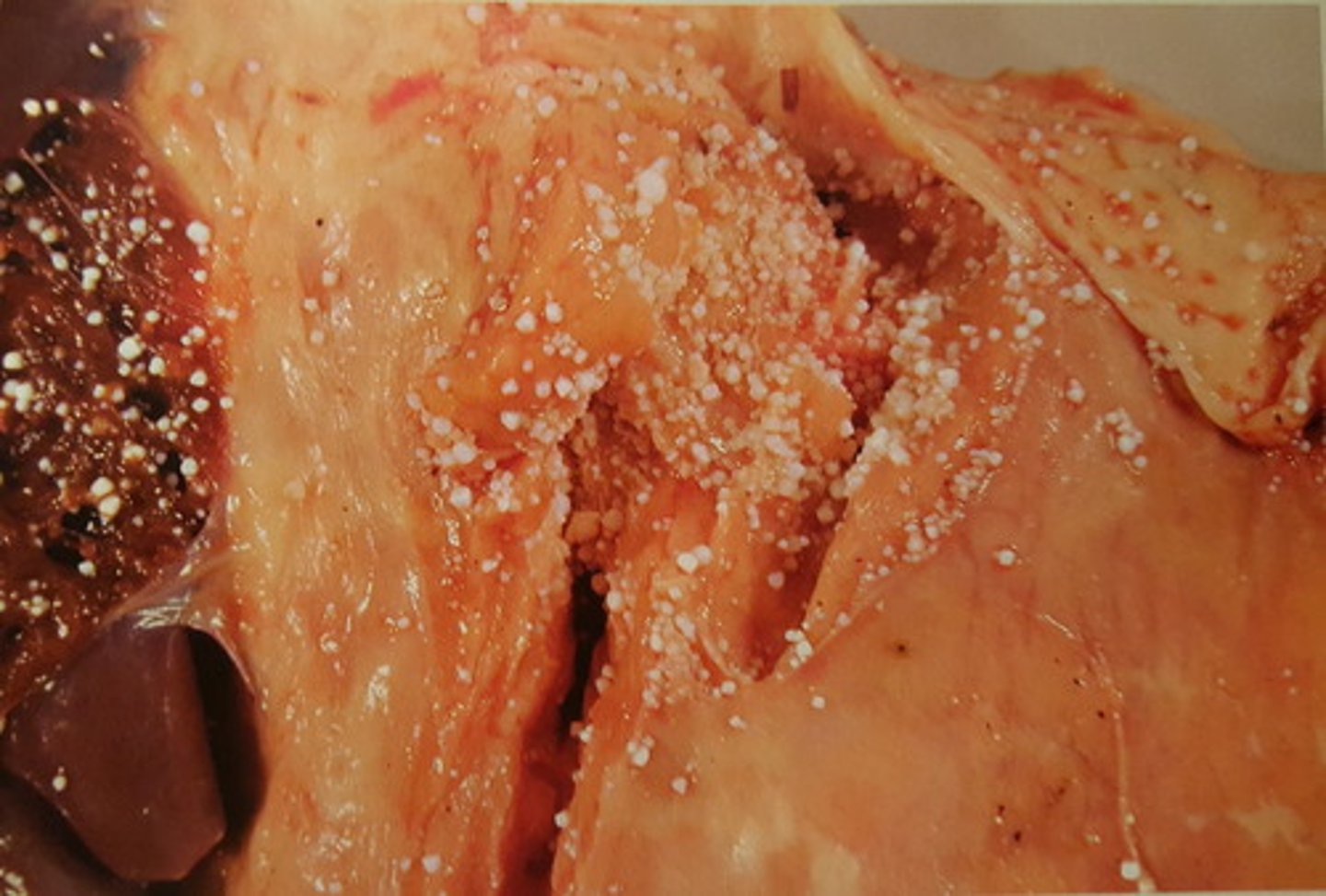 <p>Pancreas fra okse. Patoanatomisk diagnose?</p>