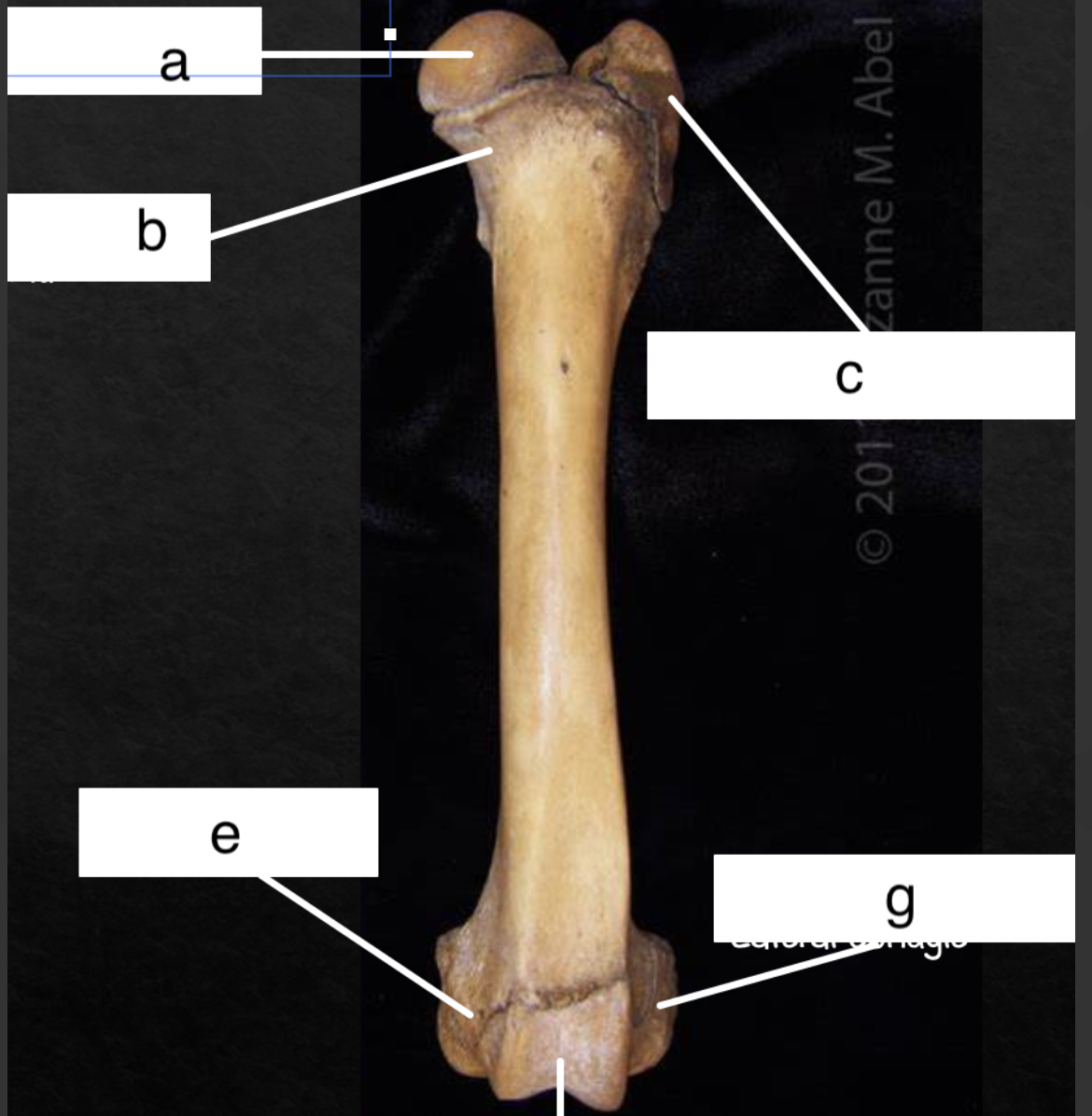 <p>lowest line (no letter) </p>