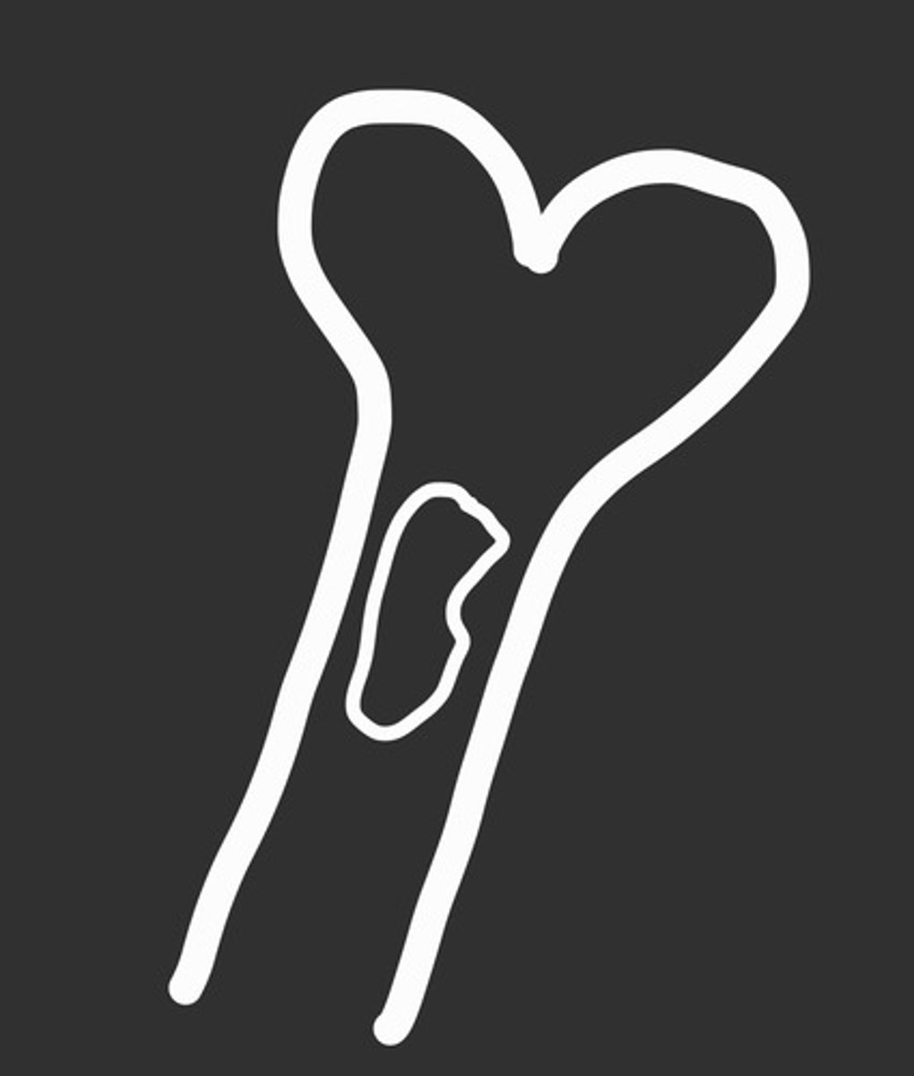 <p>not painful</p><p>what tumour does this represent?</p>