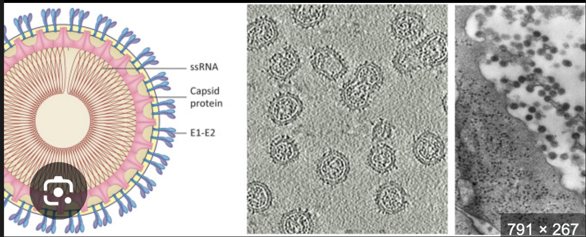 <p>What type of genome does <strong>Rubella</strong> have?</p>