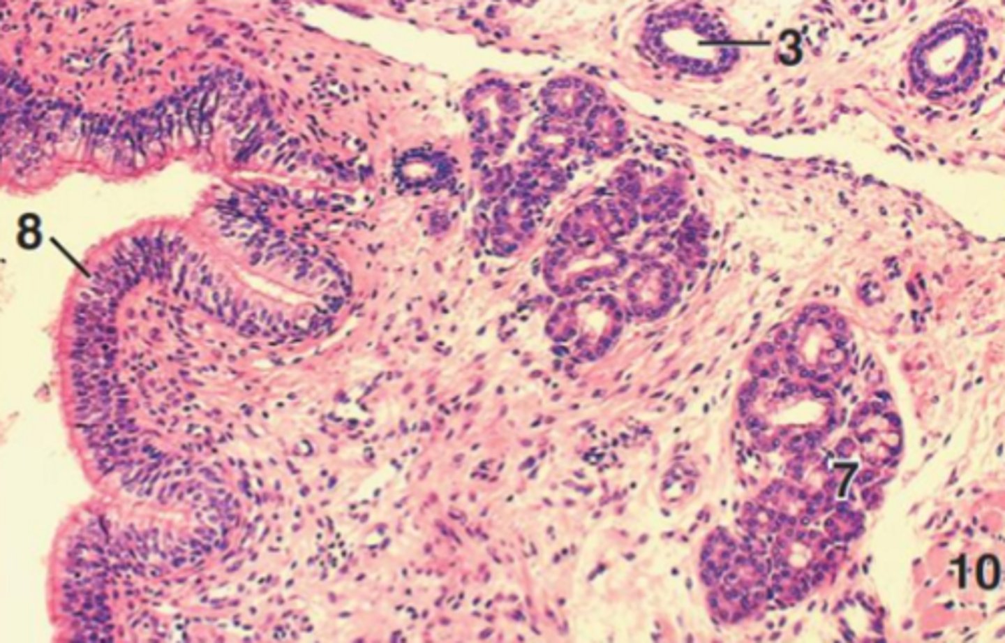 <p>- ciliated epithelium to trap and clear debris</p><p>- involved in respiration</p>