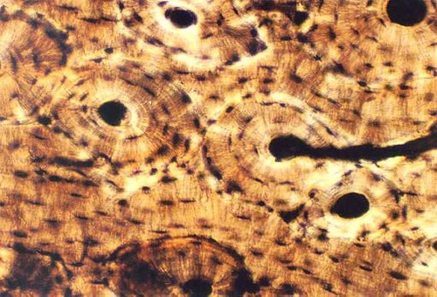 <p>dense bone structure that provides strength and support</p>