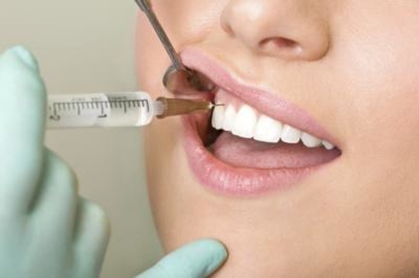 <p>n. /ˌæn.əsˈθiː.ʒə/</p><p>sự gây mê</p><p>ex: The patient was given anesthesia before the surgery began.</p>