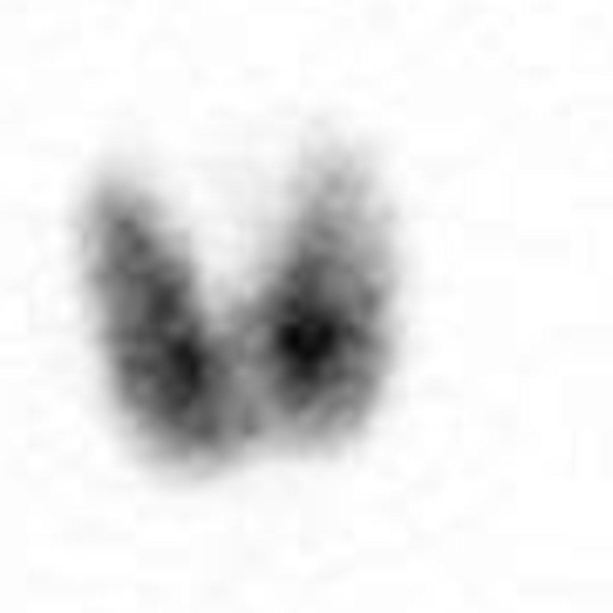 <p>What image view is this?</p>