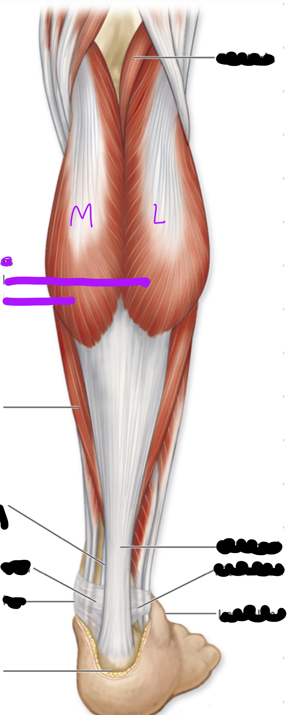 <p>Function?</p>