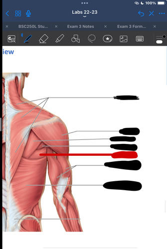 <p>What muscle is this?</p>