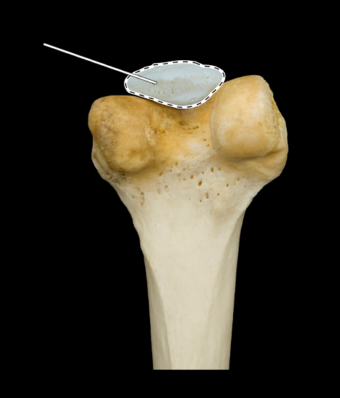 <p>Name this bone.</p><p>(Inferior posterior view).</p>