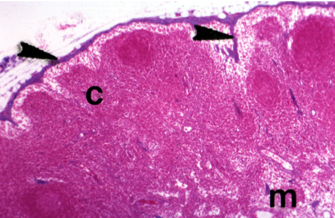 <p><strong>Lymph Nodes</strong><br>Capsule and subcapsular sinus observed</p>