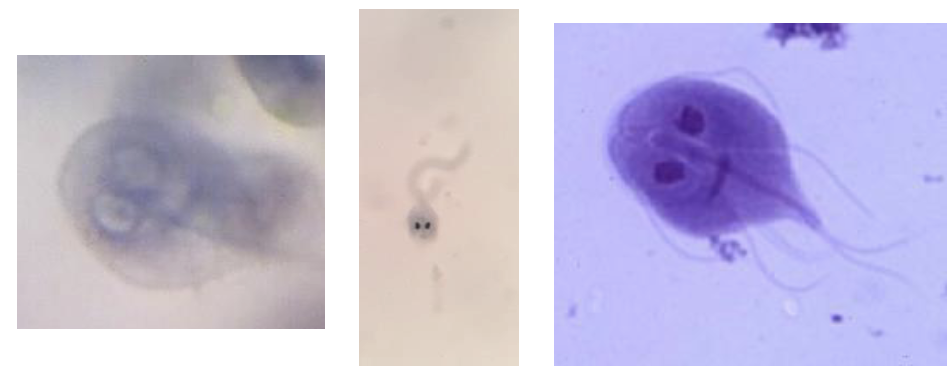 <p>What is this protozoan?</p>