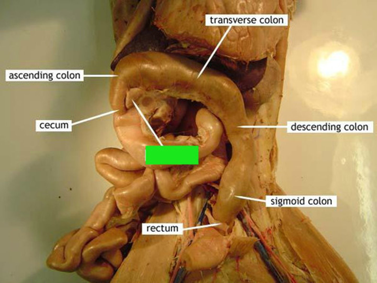 <p>Identify the structure at the green pointer box.</p>