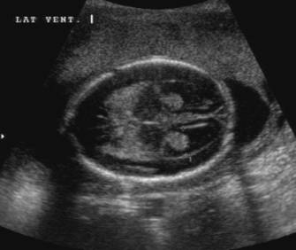 <p>What is this an image of?</p>