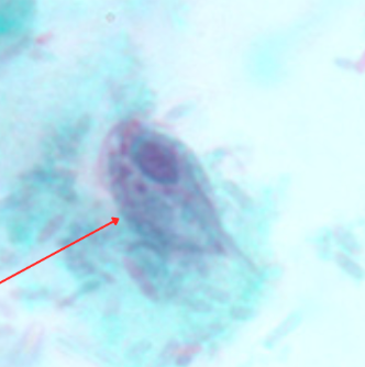 <p>Identify the organism. Give genus and species</p>