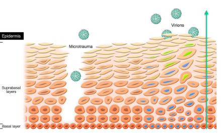 <ul><li><p>Virus replication linked to growth and</p><p>differentiation of cells in stratified squamous</p><p>epithelium (from b<strong>asal layer to top laye</strong>r)\</p></li><li><p>Microtrauma(sugat) starts infection</p><ul><li><p>Cell entry: basement membrane keratinocytes</p></li><li><p>Viral genome and E proteins enter cell nucleus</p></li><li><p>Production of copies of viral genome in episome form</p></li><li><p>Productive virus replication during terminal differentiation of host cell</p></li><li><p>Cell normally stops dividing upon terminal differentiation but it is prevented by the E protein so virus can complete its replication</p></li><li><p>Papilloma forms by increasing the keratinocyte replication</p></li></ul></li></ul><p></p>