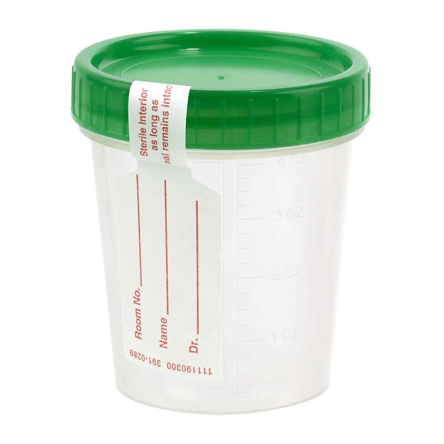 <p>What is this and which urine sample is it used for?</p>