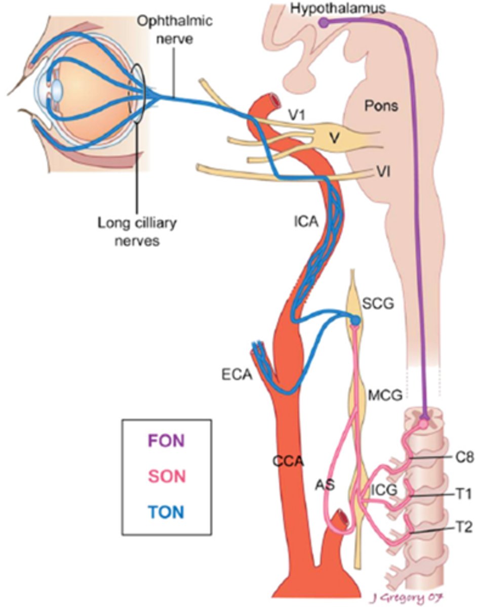 <p>benign vascular HA</p>
