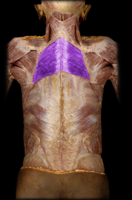 <ul><li><p>Action: Retraction (adduction) of scapula, Elevation of scapula</p></li><li><p>Origin: Spinous processes of T2-5 vertebrae</p></li><li><p>Insertion: Scapula (medial border)</p></li><li><p>Innervation: Dorsal scapular nerve</p></li></ul><p></p>