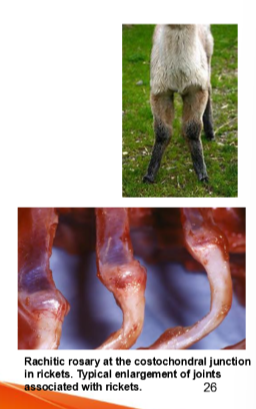 <ul><li><p>results in reduced uptake of calcium and phosphorus </p></li></ul><p>In crias: </p><ul><li><p>born with <strong>angular limb deformities, </strong>especially carpal valgus </p></li><li><p>angular limb deformities may develop by 3 to 4 months of age </p></li><li><p><strong>Rickets: </strong>shifting leg lameness and joint enlargement, especially in the carpus </p></li></ul><p>In adults: </p><ul><li><p>lameness, angular limb deformities </p></li><li><p>limb fractures, poor growth, surgical implant failure </p></li></ul><p>Diagnosis: </p><ul><li><p>blood levels normal range 75-200 nmol/l </p></li><li><p><strong>dietary analysis: examine calcium to phosphorus ratio in a growing cria (&gt;1.5) </strong></p></li></ul><p>treatment: </p><ul><li><p>supplements: provide adequate vitamin D in dietary supplements </p></li><li><p>injections for winter born crias </p><ul><li><p>administer vit A, D and E injections from 2 weeks of age until spring </p></li><li><p>caution: potential for injection site reactions and anaphylaxis </p></li></ul></li><li><p>viamin D3 gel or paste: administer every 2-3 weeks </p></li><li><p>caution: excess vit D may lead to dystrophic and renal calcification </p></li></ul><p></p>
