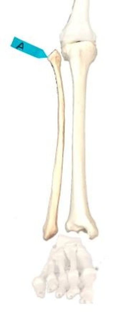 <p>Identify this bone marking.</p>