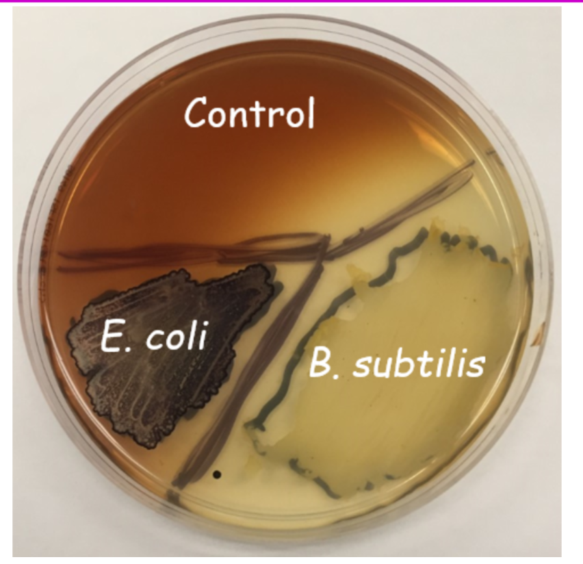 <p><span>Starch Agar – Results #2</span></p>