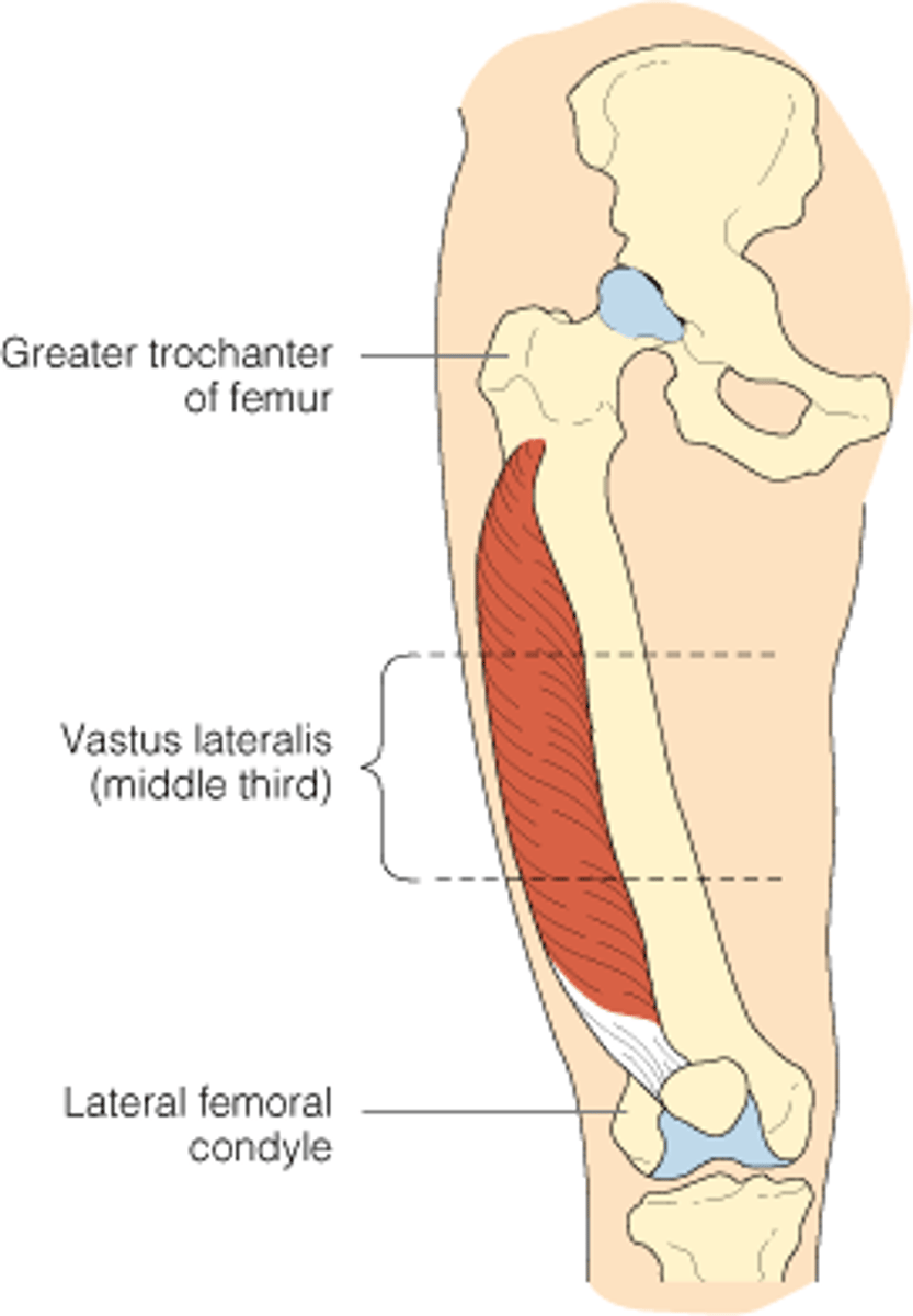 <p>Vastus lateralis</p>