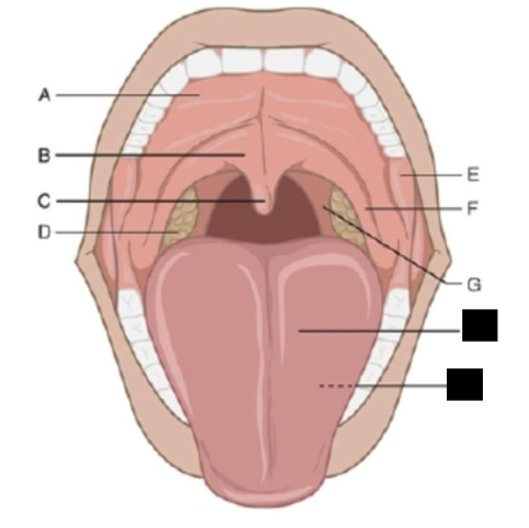 <p>label a, b, c, d in order</p>