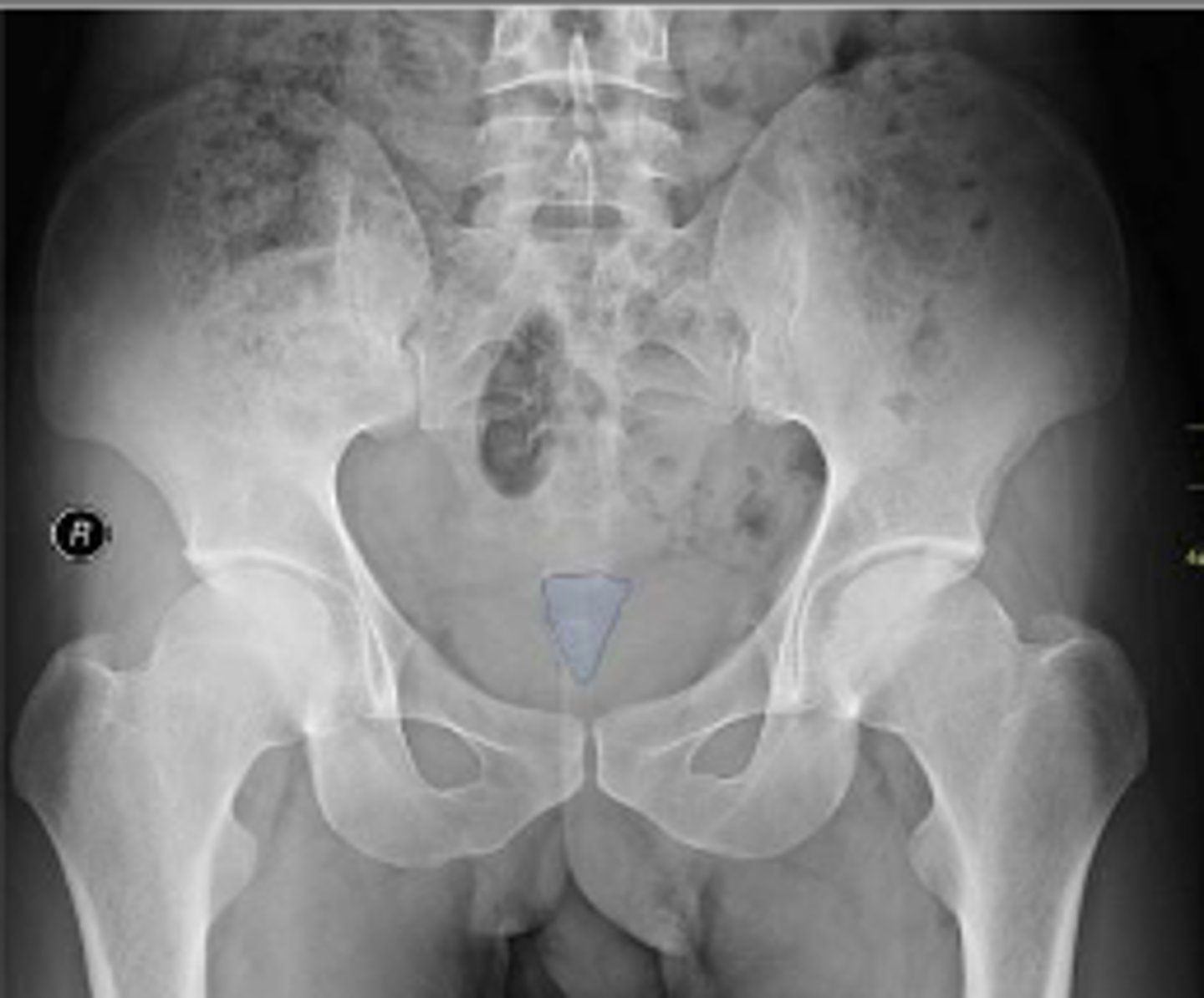 <p>What is outlined?</p>