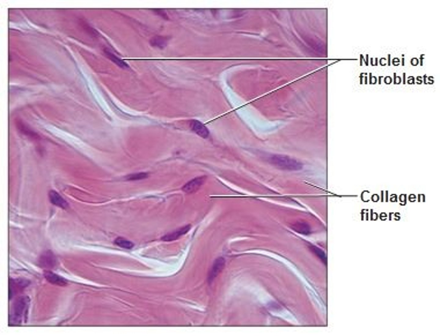 <p>Description: Fibroblast cells, many irregularly arranged collagen fibers and some elastic fibers.</p><p>Function: Provides structural strength, and withstands tension exerted in many directions.</p><p>Location: Most of the skin dermis, and capsules of organs and joints</p>