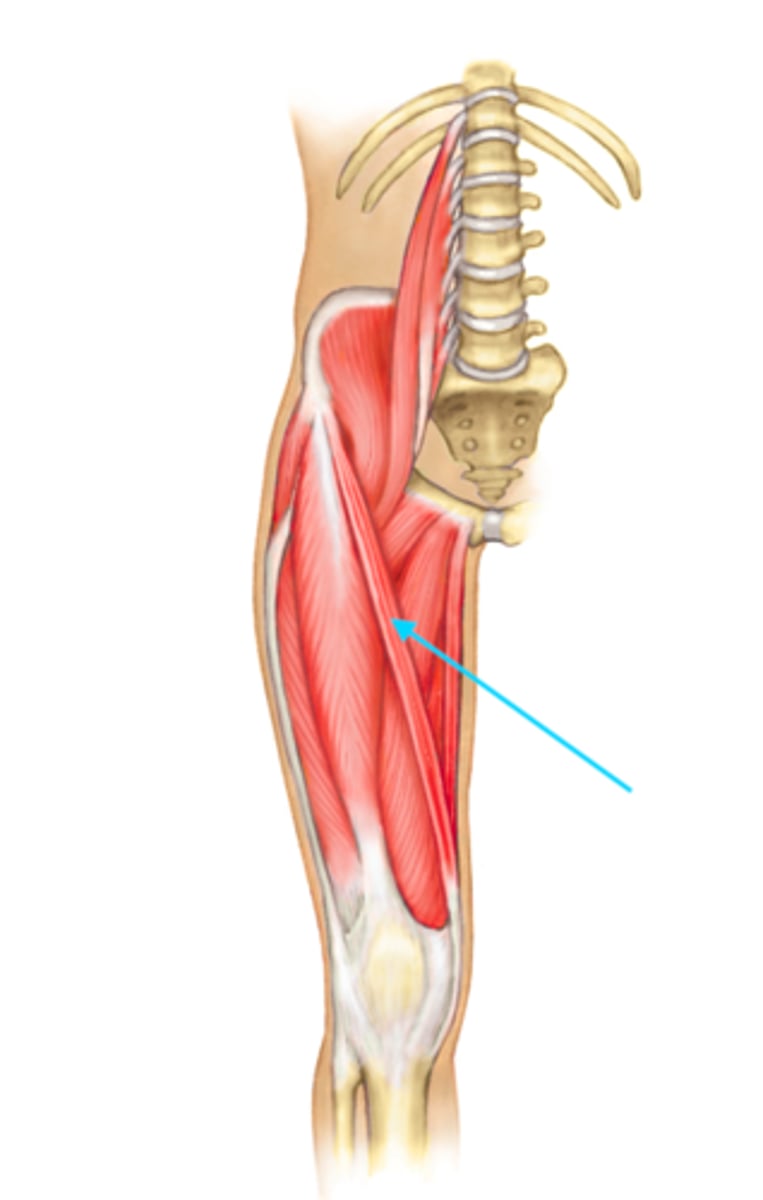 <p>anterior superior iliac spine (ASIS)</p>