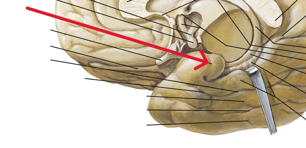 <p>Which part of the brain is:</p><ul><li><p>Almond-shaped, inside temporal</p></li><li><p>Medial and anterior to hippocampus</p></li></ul><p></p>