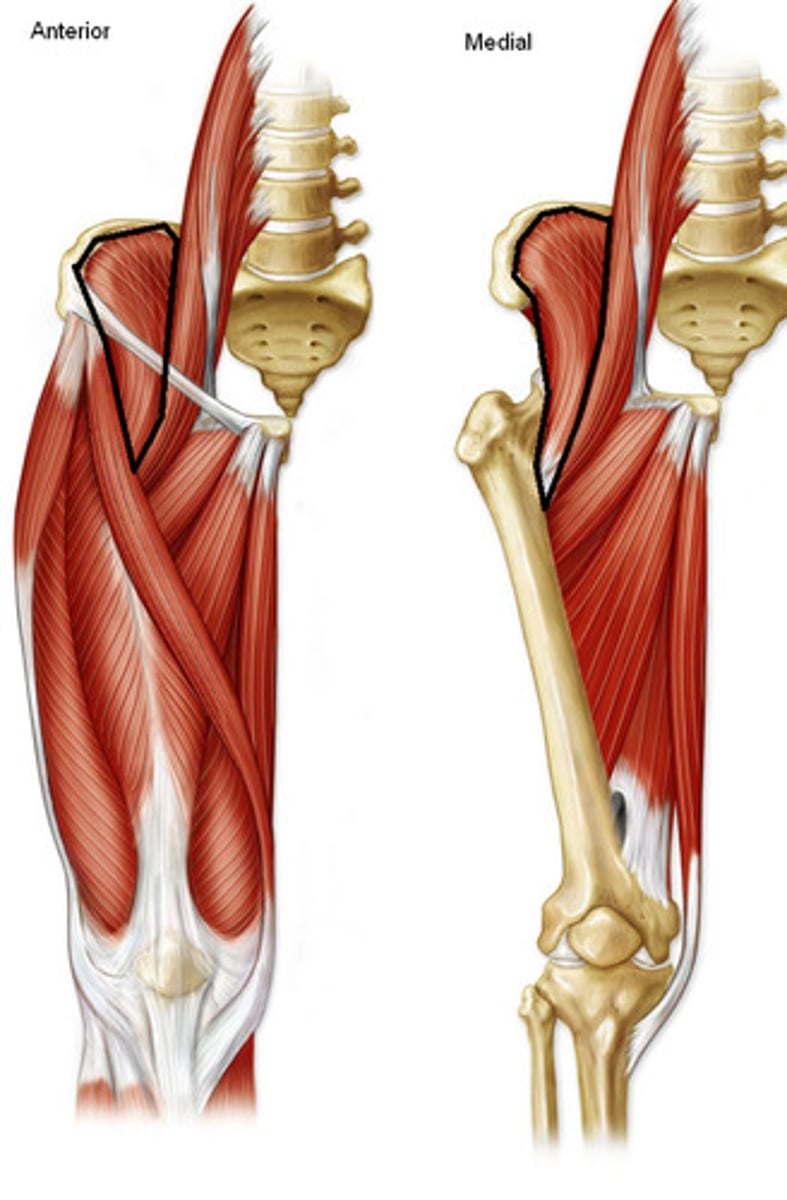<p>Origin: iliac crest, iliac fossa, ala of sacrum, and anterior sacro-iliac ligaments</p><p>Insertion: tendon of psoas major, lesser trochanter of femur and distal to it</p><p>Innervation: femoral nerve (<strong>L2, </strong>L3)</p><p>Action: acts conjointly with psoas major to flex and stabilize the hip joint</p>