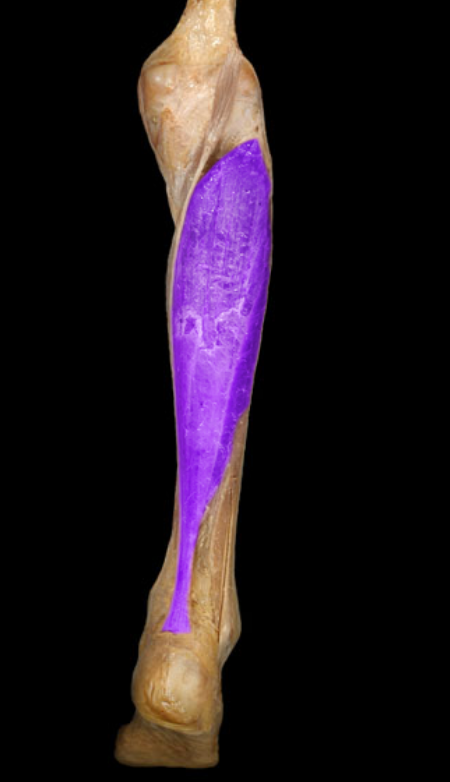 <p>deep to gastrocnemius</p>