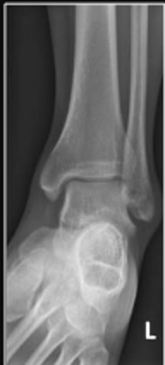 <p>What is the name of the radiographic view?</p>
