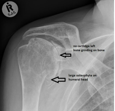 <p>What can be seen on this image? </p>