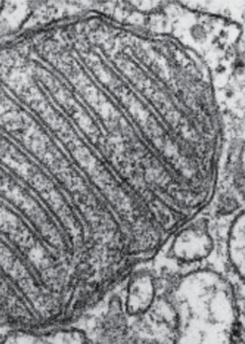 <p>What does this electron micrograph of the mitochondria reveal?</p>