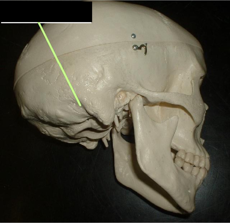 <p>a hole behind the mastoid portion</p>
