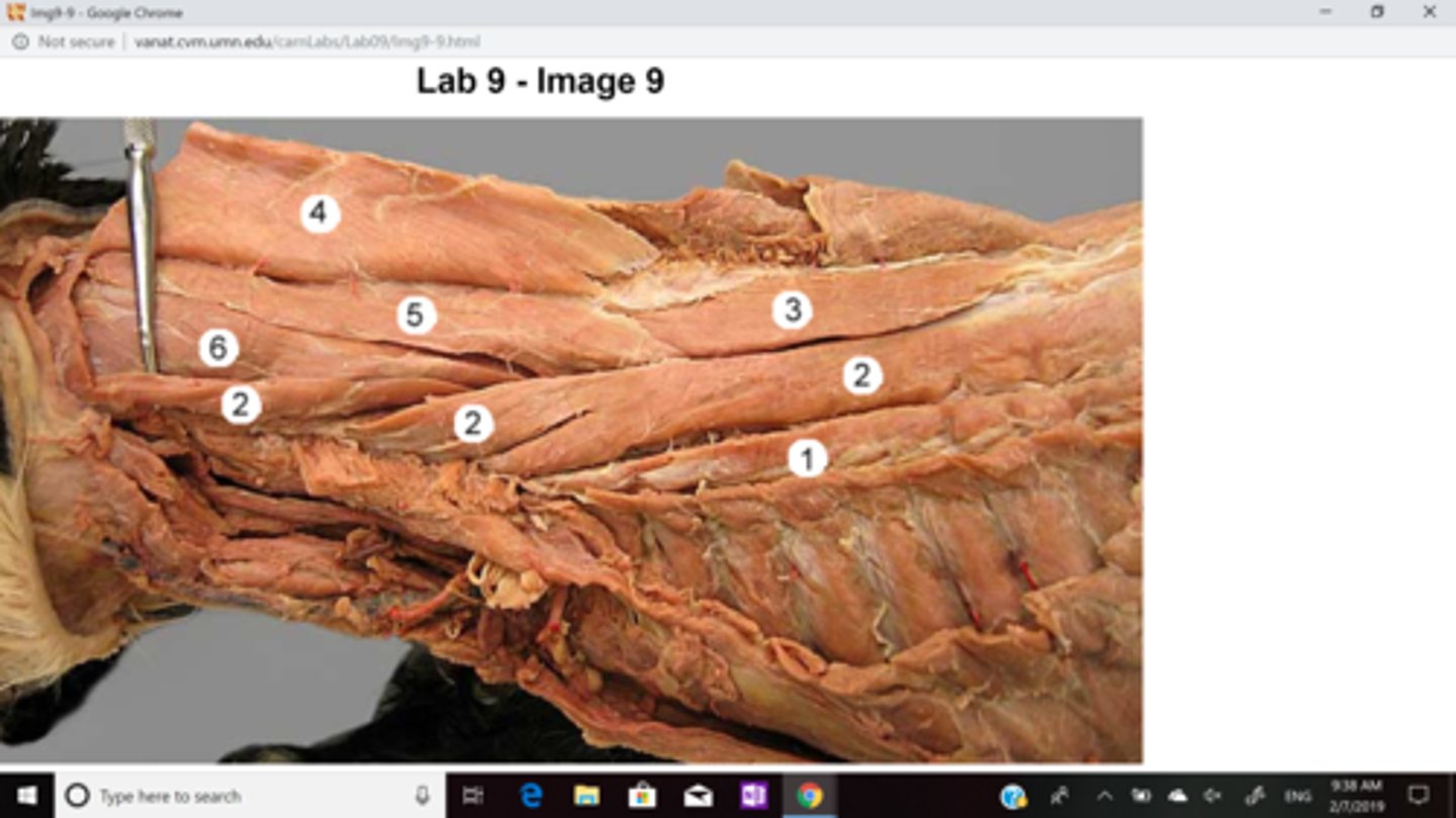 <p>Origin: transverse processes of superior thoracic vertebrae</p><p>Insertion: transverse process of middle and superior cervical vertebrae</p><p>Action:</p><p>Bilateral extend head</p><p>Unilateral laterally flexes neck to same side</p><p>Innervation: Cervical and thoracic spinal nerves</p>