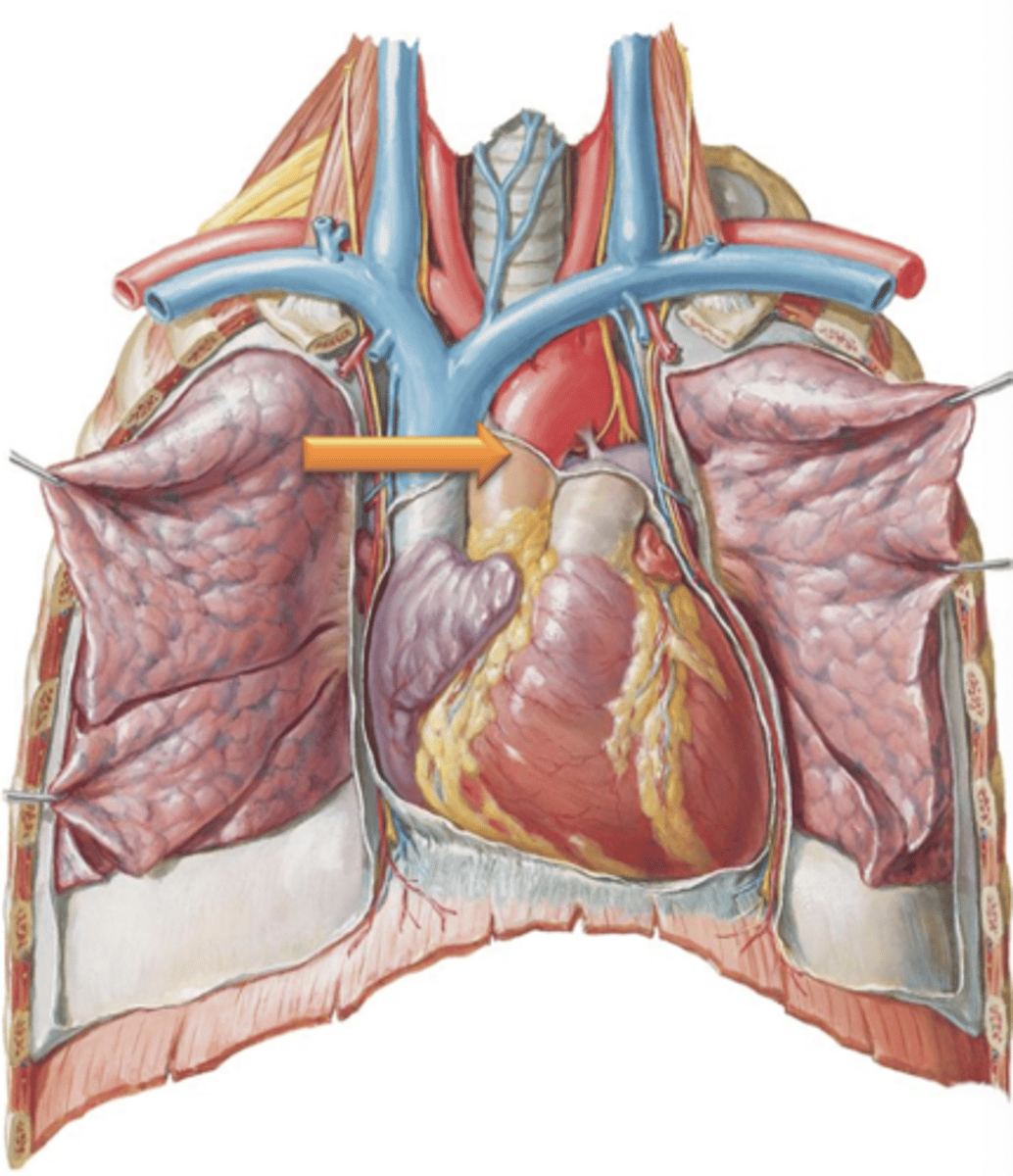 <p>Region of aorta that leads from the heart and courses superiorly.</p>