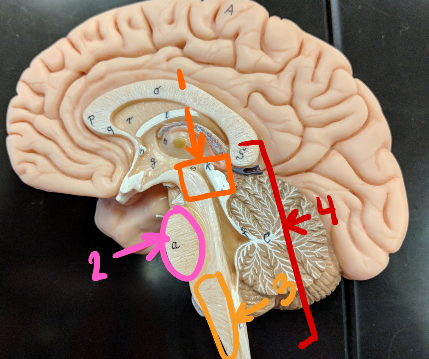 <p><strong>major regions of the brain + the spine</strong></p><p>what structure is 1? (whole structure)</p>