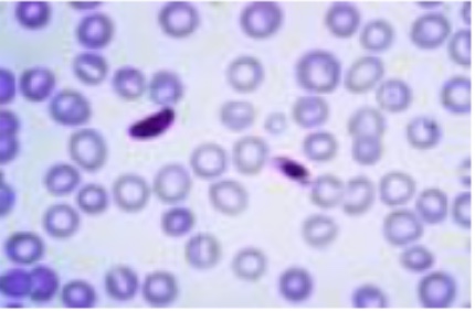 <p>What is this (classification of protozoa based on locomotion structure)</p>