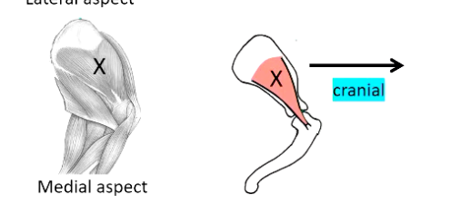 <p><strong>• Medial support:</strong></p><p>• Subscapularis muscle X</p><ul><li><p>O = Subscapular fossa</p></li><li><p>I = proximal medial humerus</p></li></ul><p>• Nerve supply = <strong>subscapular nerve</strong></p>