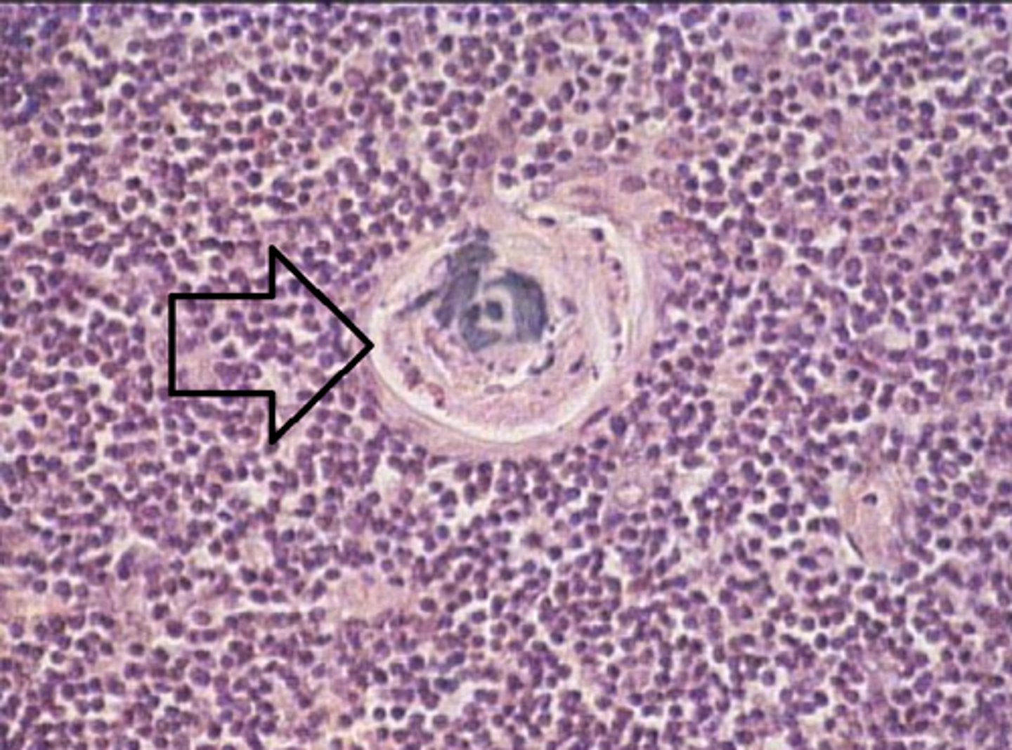 <p>Identify the structure at the arrow?</p>