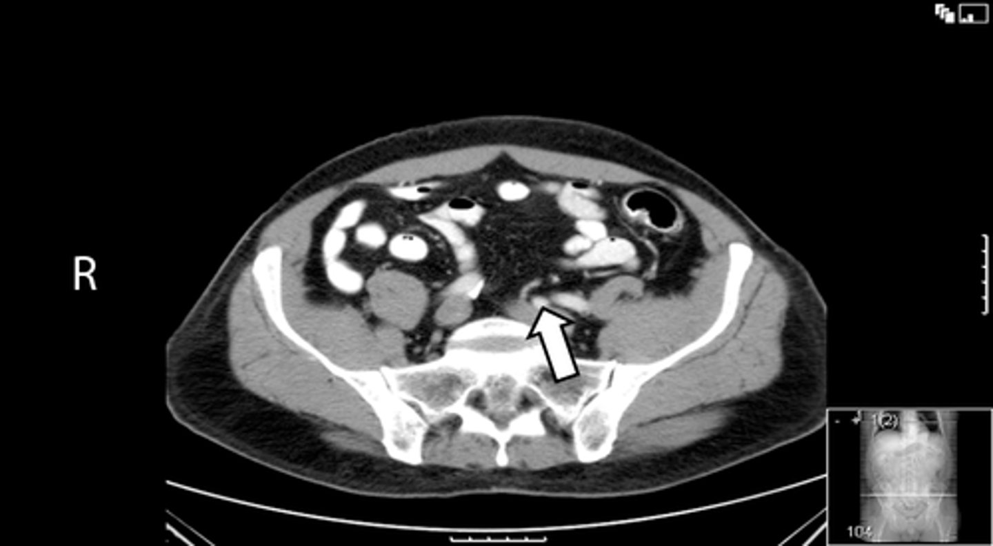 <p>What is indicated in the image?</p>